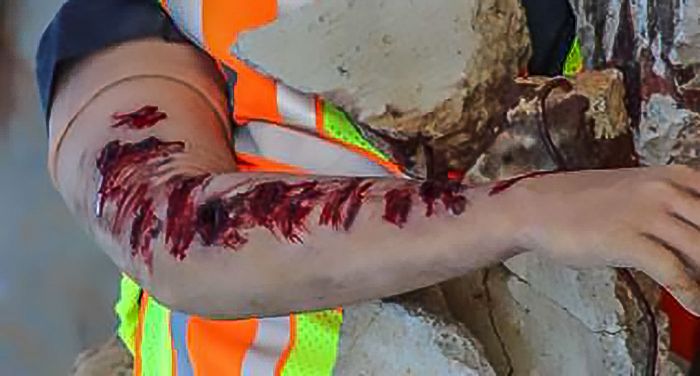 TOMManikin - BLAST image 5